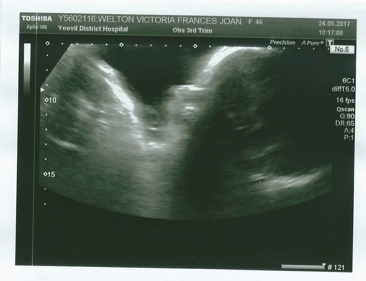 The Conception Diaries - 32 Weeks Pregnant