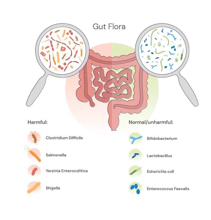 Drawn details of both harmful and normal gut flora